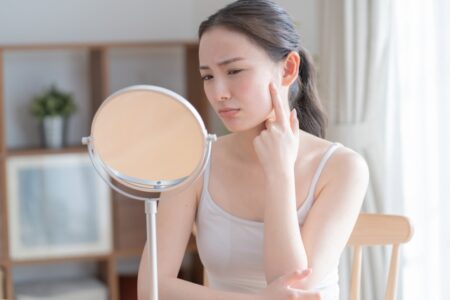 シミ・しわ・たるみの治療について